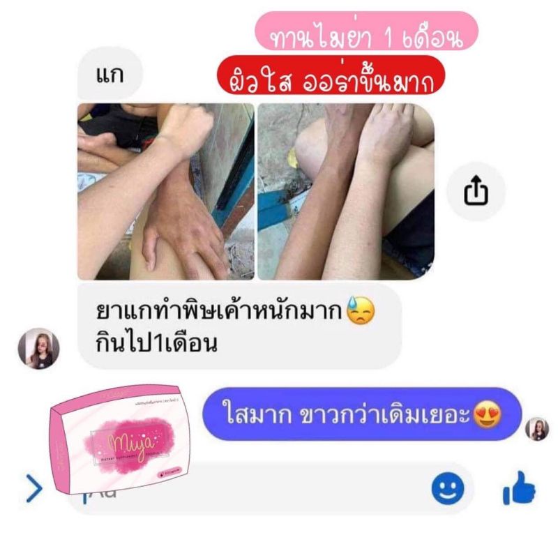 ไมย่าmiya-1แถม1วิตามินคอลลาเจนผิวขาว-อาหารเสริมบำรุงผิว