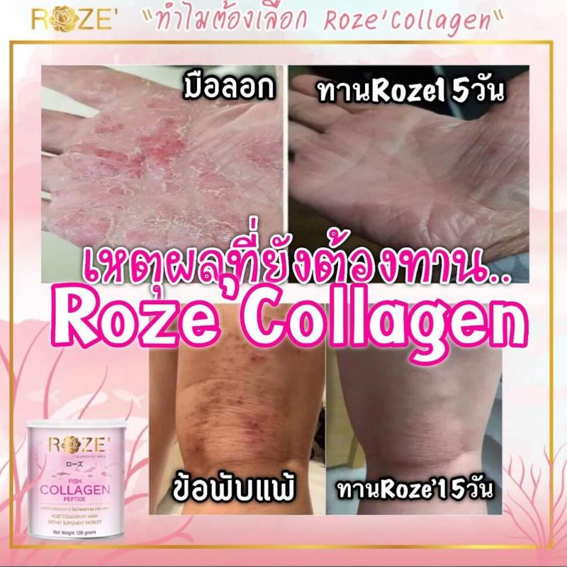 roze-collagen-จ่ายปลายทางได้-roze-collagen-ของแท้