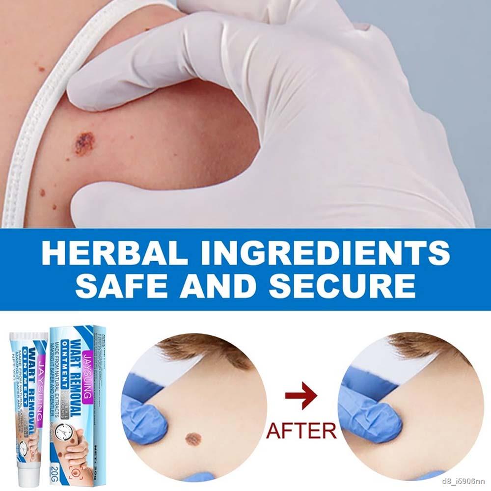 wart-removal-cream-skin-tags-treatment-safe-painless-herbal-antibacterial-ointment-foot-corn-removal-beauty-body-skin-ca