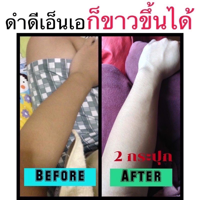 ของแท้-โสมมะพร้าวกลูต้า-โสมมะพร้าว-ผิวขาวใน-7-วัน-ขนาด-500-กรัม