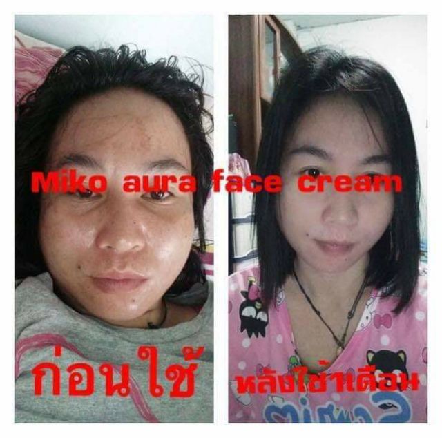 ของแท้-มีของแถม-miko-aura-face-cream-มิโกะ-ออร่า-เฟซ-ครีม-ลดเลือน-สิว-ฝ้า-กระ-จุดด่างดำ-ปรับผิวหน้าให้ขาว-กระจ่างใส