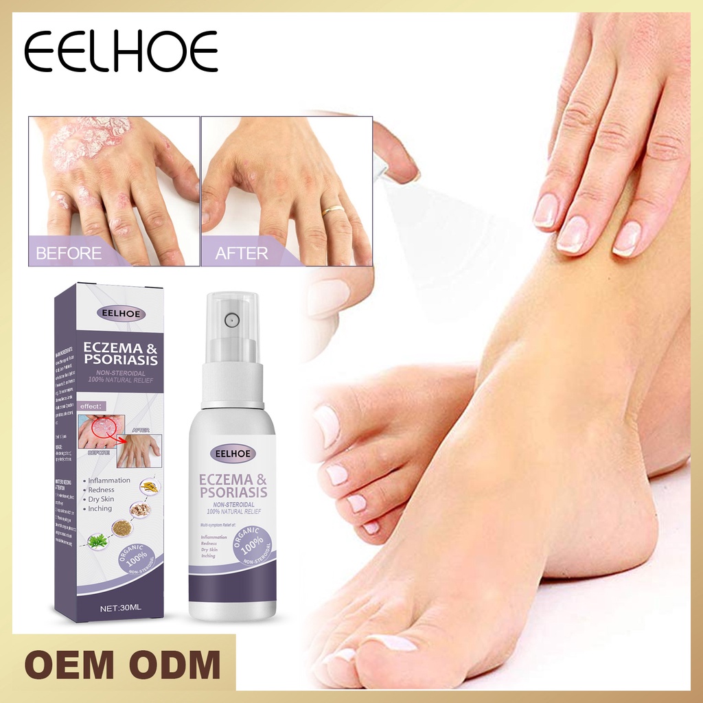 eelhoe-tinea-pedis-spray-ยาสมุนไพรจีน-บรรเทาอาการคัน-โรคผิวหนัง-โรคสะเก็ดเงิน-โรคเชื้อรา-ยารักษาโรคเรื้อรัง-พลาสเตอร์กลาก-doom