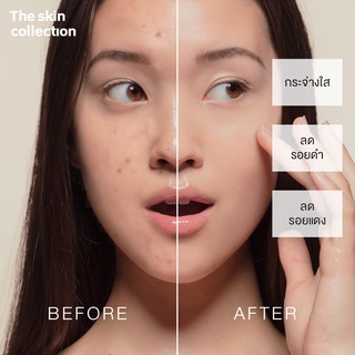 ภาพขนาดย่อของภาพหน้าปกสินค้าเซรั่มช่วยให้ผิวกระจ่างใส แก้ปัญหาผิวจากรอยดำ รอยแดง The Skin Collection Serum Niacinamide10% + NAG8% 30ml จากร้าน tsc_official บน Shopee ภาพที่ 5