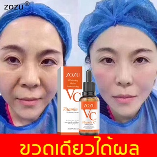 ใช้ดีมาก zozu ครีมต่อต้านริ้วรอย ครีมลดริ้วรอย 30ML ลดเลือนริ้วรอย ผิวขาวใส ยกกระชับ แก้ต้นตอของริ้วรอย ครีมหน้าขาวใส