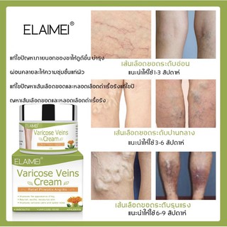 สินค้า Varicose Veins Cream สำหรับทาเส้นเลือดขอด เป็นยาทาเส้นเลือดขอดที่ช่วยส่งเสริมการไหลเวียนเลือดบรรเทาอาการบวมชา 50 กรัม