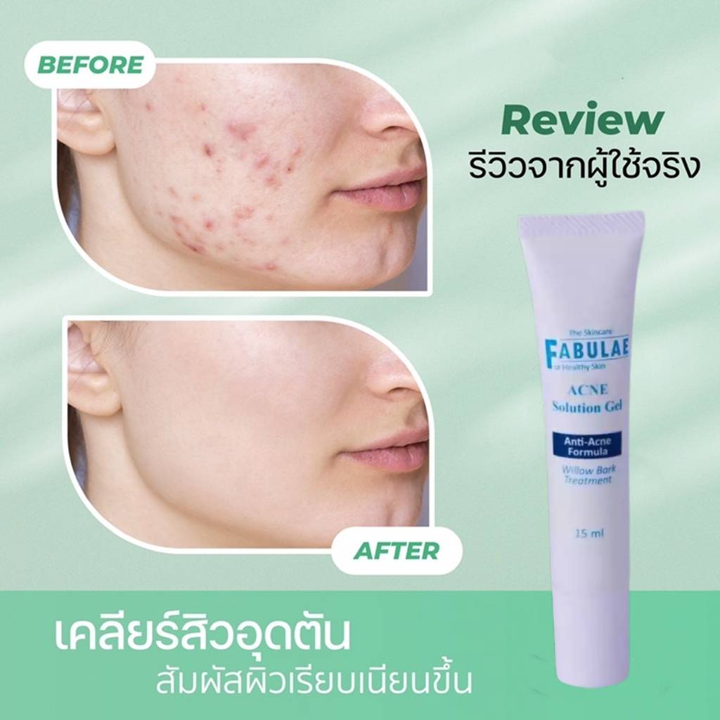 พร้อมส่ง-the-skincare-fabulae-เจลรักษาสิว-เจลล้างหน้า-เจลรักษาสิว-แพ้ง่าย-คลีนซิ่ง-วอเตอร์-fabulae-n9