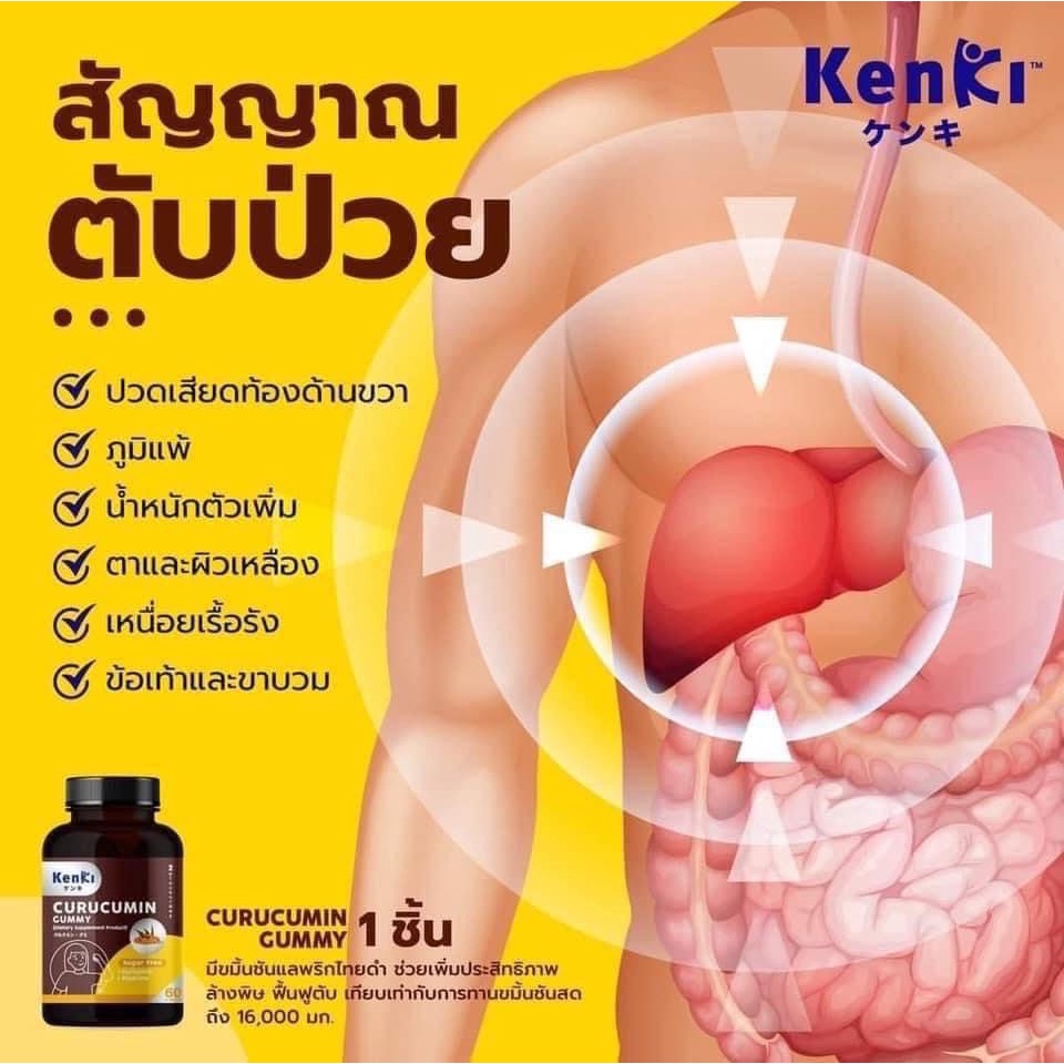 มีโค้ดส่วนลด-kenki-curucumin-gummy-วิตามิน-กัมมี่-คุรุคุมีน-สูตรล้างพิษในตับ-ฟื้นฟูและ-บำรุงตับ-ลดไขมันพอกตับ-ส่งฟรี