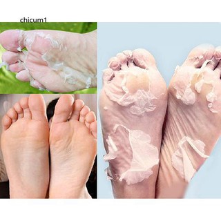 CHC_2Pcs Milk Bamboo Vinegar Dead Skin Remove Foot Skin Smooth Exfoliating Feet Mask