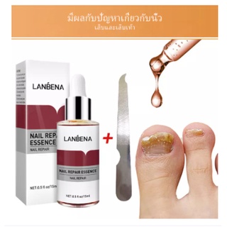 LANBENA เซรั่มบำรุงเล็บ ป้องกันเชื้อรา น้ำมันบำรุงเล็บ เอ็สเซ้น ซ่อมแซมเล็บเสีย รักษาโรคเชื้อราที่เล็บแก้ไขปัญหาเล็บต่าง