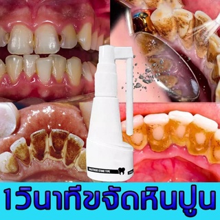 ถนอมสุขภาพช่องปากและทำความสะอาด น้ำยาขจัดคราบฟัน ฟอกสีฟัน ขจัดคราบพลัค ป้องกันฟันผุ ลดกลิ่นปาก ทำความสะอาดฟัน บูรณะฟันเห