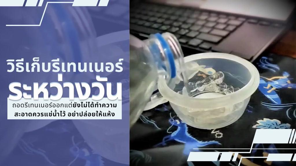 น้ำยาทำความสะอาดรีเทนเนอร์-และฟันปลอม-z4-anti-plaque-400ml-พร้อมกล่องแช่รีเทนเนอร์ปกติ-70-มีกล่อง-2-ขนาดโปรดระบุ