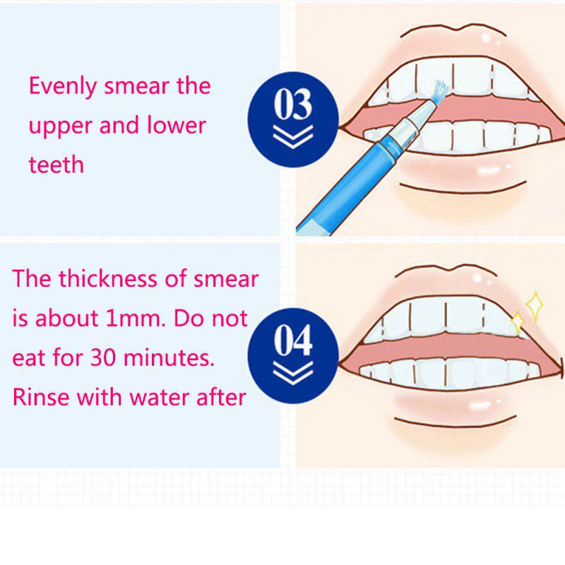 ปากกาฟอกสีฟันขาว-ปากกาฟอกสีฟัน-ปากกาฟอกสีฟันทันที-ทําความสะอาดเจลโรตารี่เปอร์ออกไซด์
