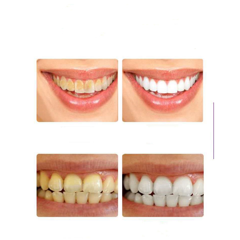 ยาสีฟันเบกกิ้งโซดา-สมุนไพร-ฟอกฟันขาว-ลดกลิ่นปาก-ลดครบหินปูน-ฟันเหลือง-baking-soda-tooth-protection-220-กรัม-30125