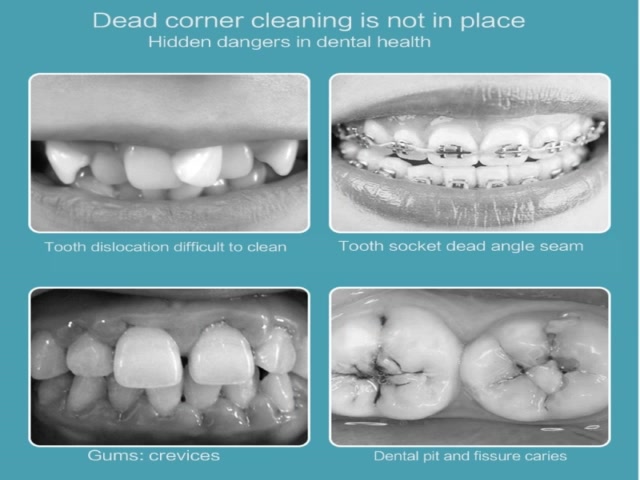 comereally-ไหมขัดฟัน-ไหมขัดฟัน-ขนแปรงนุ่ม-สําหรับดูแลช่องปาก-1-ชิ้น