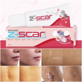 (หมดอายุ 16/9/23) ERDEE Zesca Z-scar เออดี ซีสกา 10 g เจลทาแผลเป็น รอยสิว คีลอยด์  อีสุกอีใส รอยดำ รอยแผลผ่าตัด