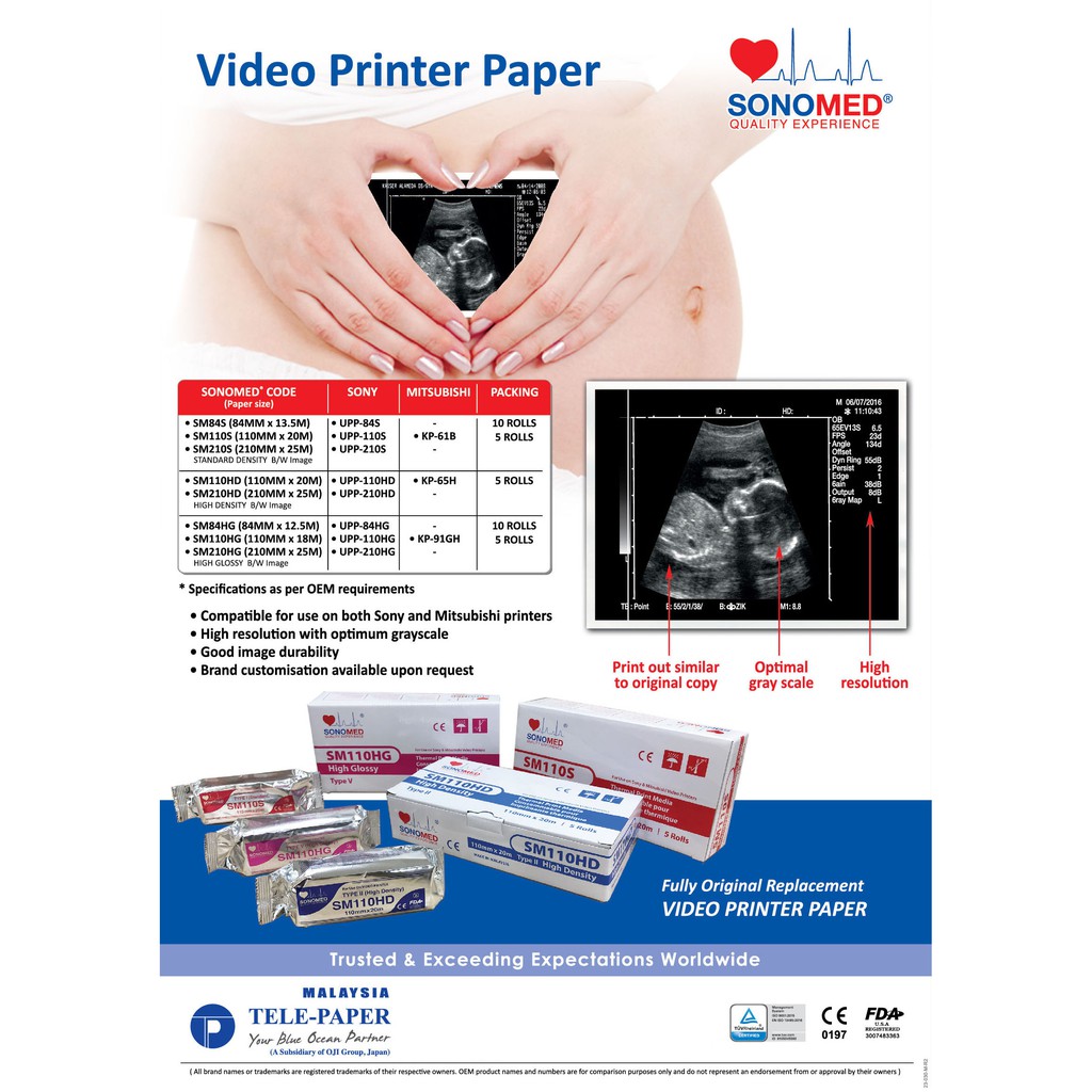 ภาพหน้าปกสินค้ากระดาษปริ้นอันตราซาวด์ทางการแพทย์ SONOMED Thermal paper for Ultrasound (ultrasound printer paper)