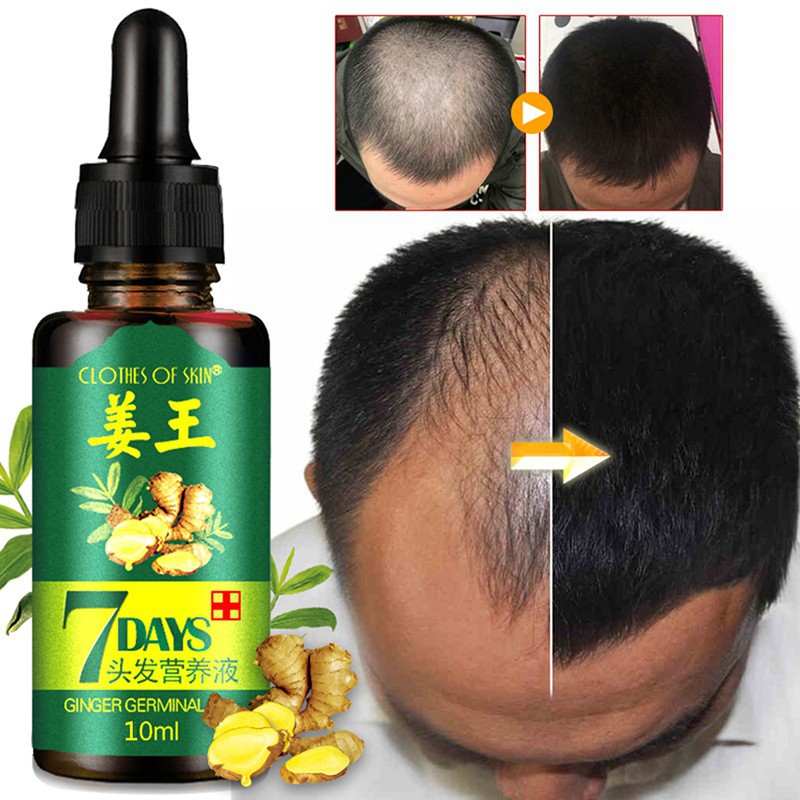 exo-hair-loss-treatment-ginger-hair-growth-serum-for-thicker-healthier-hair
