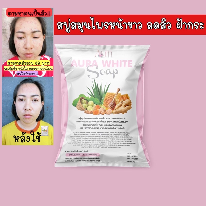 สบู่หน้าขาวรักษาสิว-ฝ้า-กระ-หน้าติดสาร-สบู่สมุนไพร-16-ชนิด-aura-white-soap-แบรนด์aum