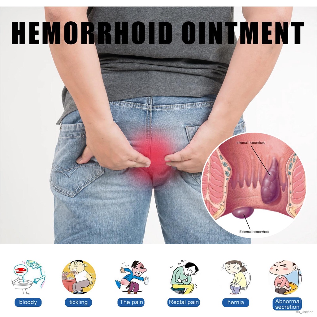 hemorrhoids-ointment-plant-herbal-relieve-anal-pain-anal-fissure-internal-external-hemorrhoids-antibacterial-cream