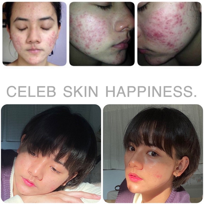 celeb-skin-happiness-akira-pore-tightening-emulsion-6g-ราคา-1-355-baht