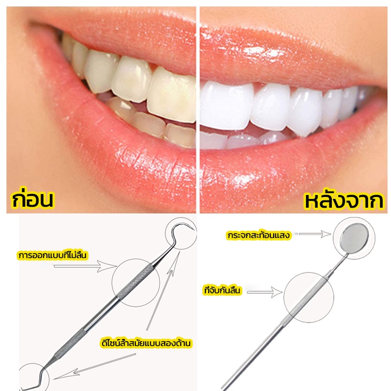 ชุด6ชิ้น-ชุดเครื่องมือทันตกรรม-ช่องปาก-เครื่องมือขูดหินปูนทำ