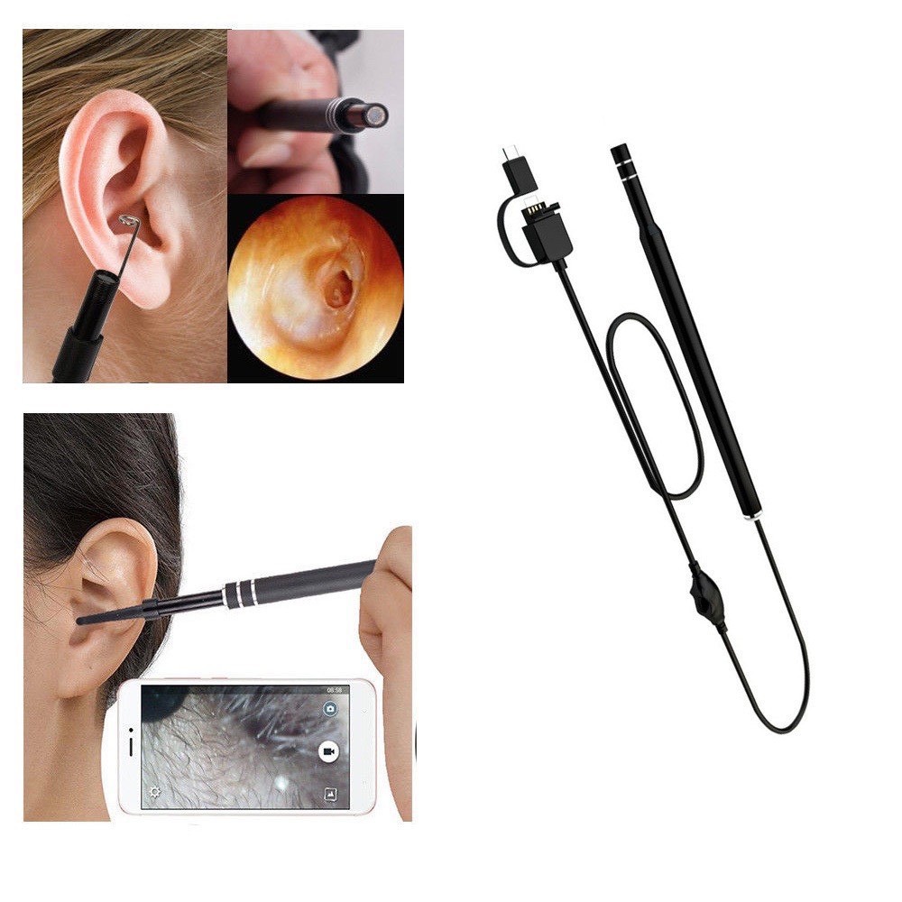 กล้องส่องตรวจหู-กล้องส่องหู-hd-visual-earwax-clean-tool-รุ่น-earwax06a-j1