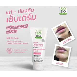 SOBIO etic | Hydra Aloe Vera Dermo-Defense cream 50ml. สำหรับผิวแพ้ง่าย เติมน้ำให้ผิวชุ่มชื้น เนียนนุ่ม ไม่แห้งตึง