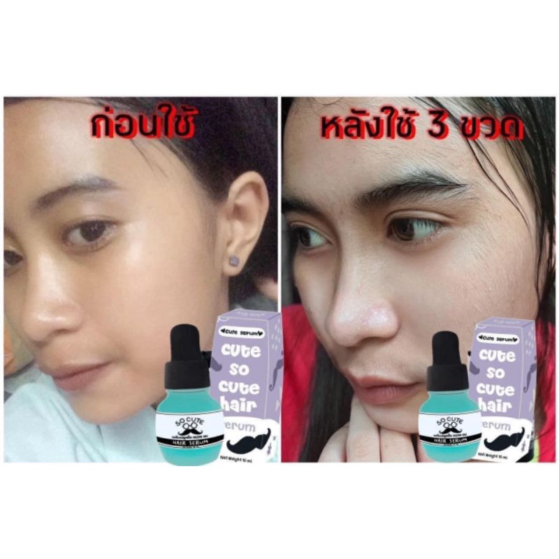 เซรั่มปลูกคิ้ว-หนวด-ผม-ขนตา