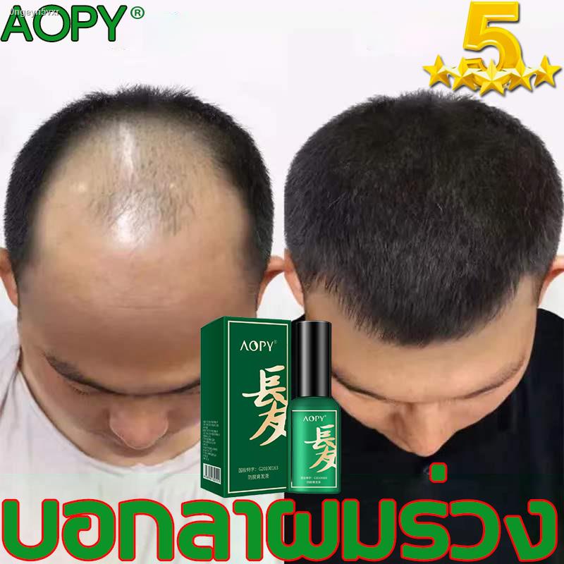 จัดส่งทันที-บอกลาปัญหาผมร่วง-aopy-30g-เซรั่มบำรุงผม-บำรุงผม-ลดผมร่วง-หยุดผมร่วง-เร่งผมยาว-ให้คุณบอกลาปัญหาผมร่วง-ฟื้