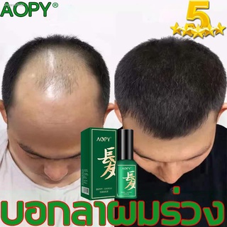 จัดส่งทันที บอกลาปัญหาผมร่วง AOPY 30g เซรั่มบำรุงผม     บำรุงผม ลดผมร่วง หยุดผมร่วง เร่งผมยาว ให้คุณบอกลาปัญหาผมร่วง ฟื้