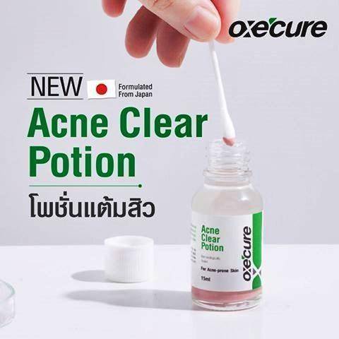 oxe-cure-acne-clear-potion-อ๊อกซีเคียว-แอคเน่-เคลียร์-โพชั่น-แต้มสิว-รักษาสิว-บำรุงผิวหน้า-ขนาด-15-ml-1-ขวด