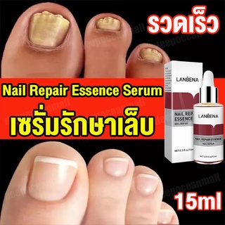 [แถมฟรี!ตะไบเล็บ] LANBENAเซรั่มบำรุงเล็บ ปรับปรุงเล็บให้แข็งแรงและมีสุขภาพดีใน2-4 สัปดาห์(ยาหยอดเล็บขบ เซรั่มรักษาเล็บพั