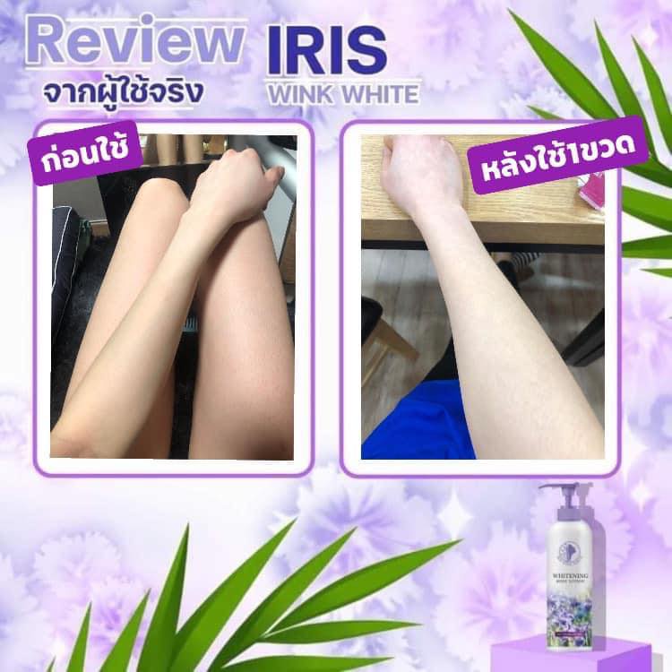 โลชั่นไอริส-iris-whitetening-ไอริส-iris-wink-white-หัวเชื้อผิวขาวของแท้-100