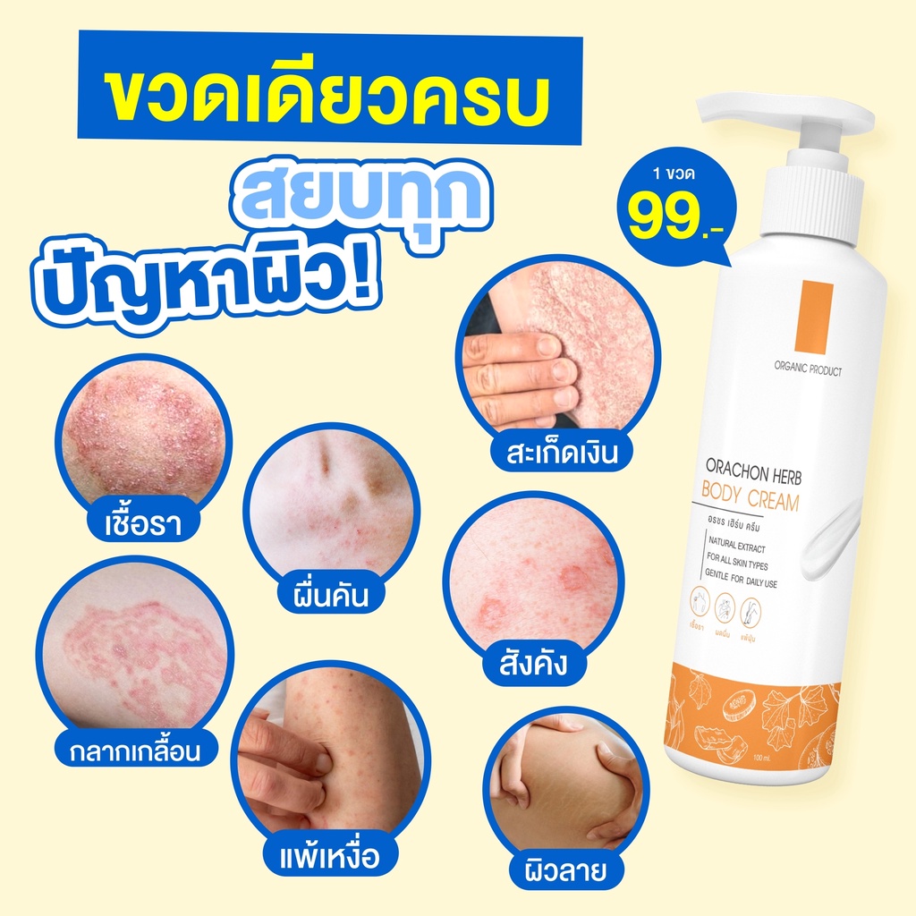 พร้องส่ง-gt-orachon-ครีมอรชร-เฮิร์บ-เชื้อรา-กลากเกลื้อน-หายขาด