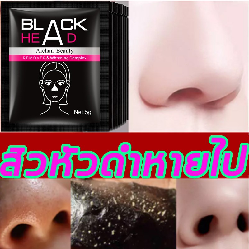 aichun-ที่ลอกสิวเสียน-สิวเสี้ยน-กำจัดสิวหัวดำสิว-ลอกสิวหัวดกำจัดสิวเสี้ยน-ครีมลอกสิว-ครีมถ่านไม้ไผ่ครีมกำจัดสิวเสี้ยน