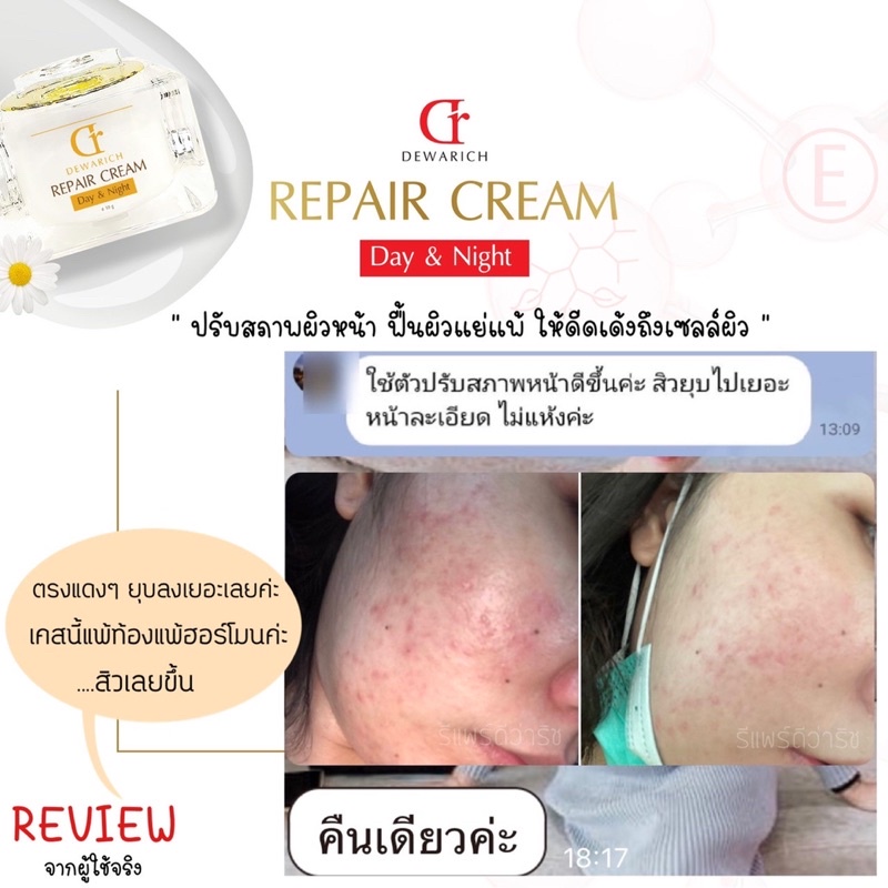 preme-repair-cream-ปรับผิวเสียสู่ผิวสวย-ฟื้นฟูผิวให้แข็งแรง