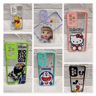 Case 💁📲 เคสประกบ ลายการ์ตูน น่ารัก รุ่น Oppo PocoX3 A16K A95 A76 Reno5