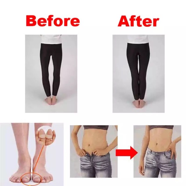 2pcs-fast-ลดน้ำหนัก-toe-แหวนแม่เหล็ก-slimming-body-ผลิตภัณฑ์นวดเท้าไขมัน-keep-fit-shaper-ที่ดีที่สุดขาย