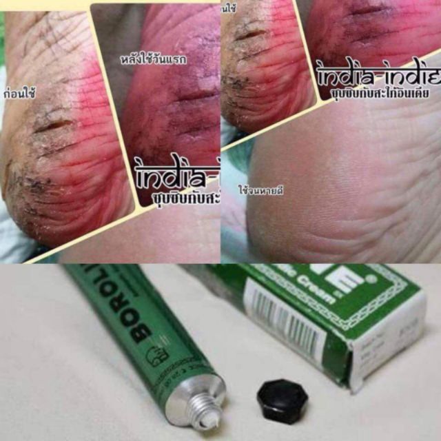 boroline-antiseptic-cream-รักษาผิวแตกแห้งส้นเท้าแตก-ผิวด้านดำตามเข่าข้อศอก-ครีมสารพัดประโยชน์ประจำบ้าน