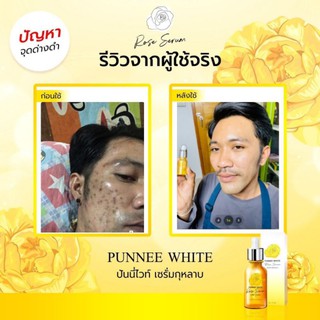 รับตัวแทนจำหน่ายต้นสาย✅แจกทองทุกเดือน✨เซรั่มกุหลาบหน้าใส  เห็นผลตั้งแต่ขวดแรก punnee white serum