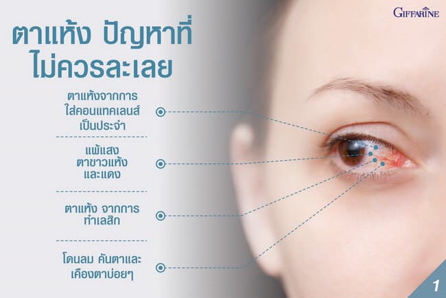 อควาเทีนร์-กิฟฟารีน-อาหารเสริมเพิ่มน้ำตา-อาหารเสริมแก้ตาแห้ง-อาหารเสริมลดอาการตาแห้ง-ยาให้ความชุ่มชื่นตา-ยาเสริมตาแห้ง