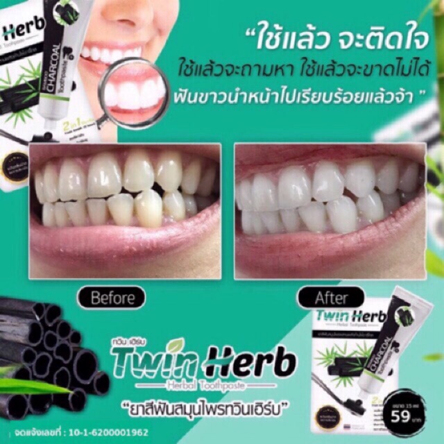 พร้อมส่ง-ยาสีฟันสมุนไพรทวินเฮิร์บ-twinherb-5หลอด