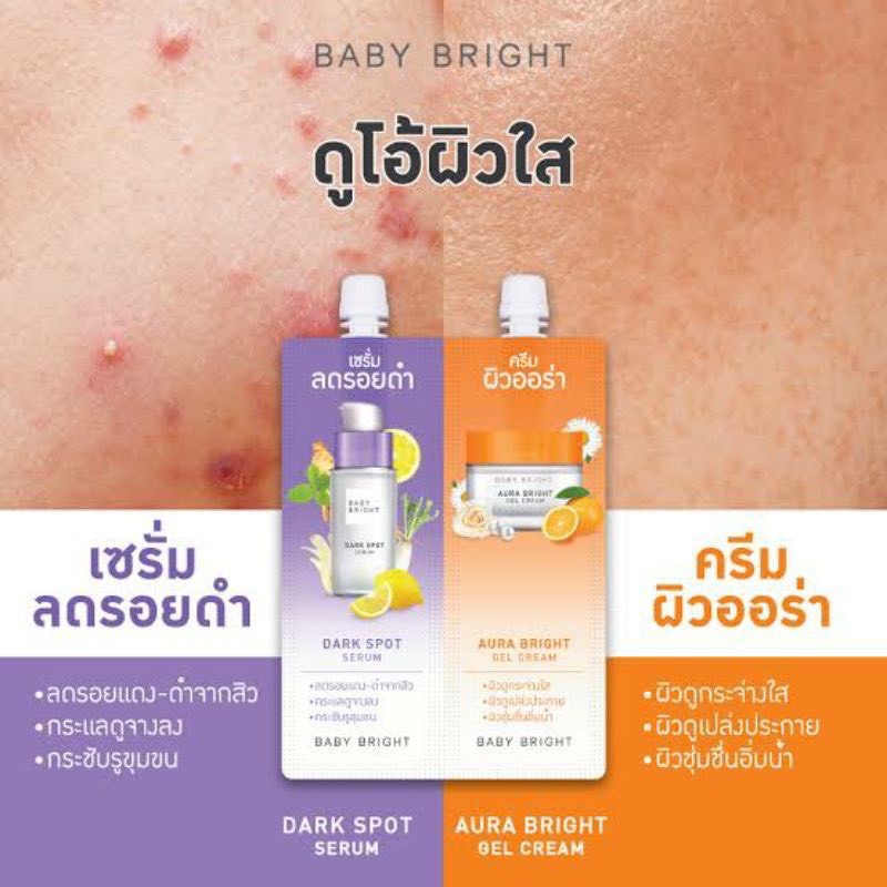 baby-bright-ดูโอบูสเตอร์ดาร์กสปอตเซรั่มแอนด์ออร่าไบร์ทเจลครีม-6g-6g