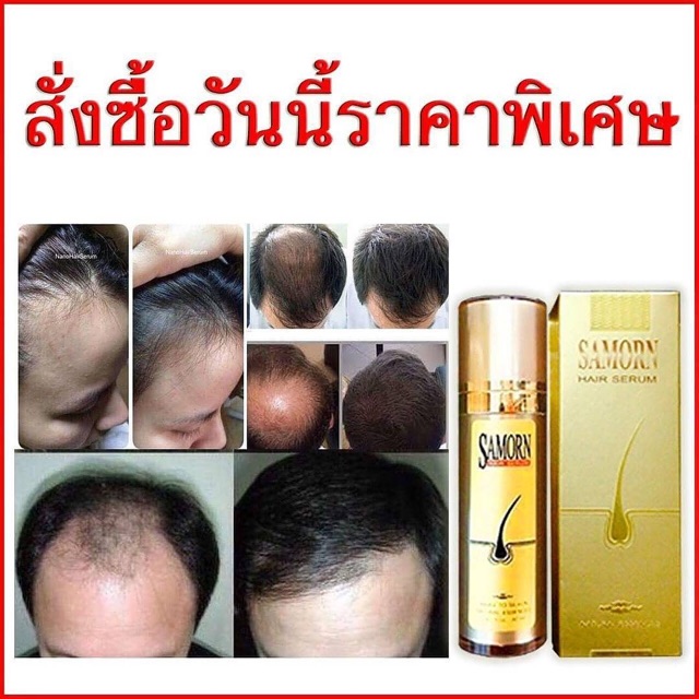 เซรั่มปลูกผมแซมออน-samorn-hair-serum-มีเก็บปลายทาง