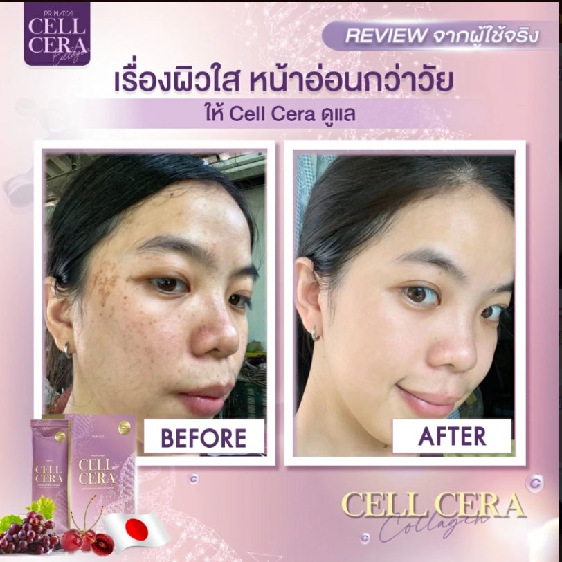 ส่งฟรี-เซลล์เซล่า-คอลลาเจน-cell-cera-callagen-บำรุงผิว-ชะลอวัย-ผิวขาว-กระจ่างใส-รูขุมขนกระชับ-หน้าอ่อนวัย-ลดผ้า-กระ