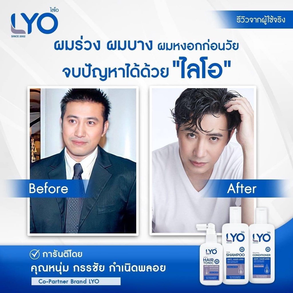 โปรสุดคุ้ม-lyo-ไลโอ-ผลิตภัณฑ์ดูแลเส้นผม-hair-tonic-บำรุงเส้นผม-ลดผมบาง-ผมร่วง-รังแค