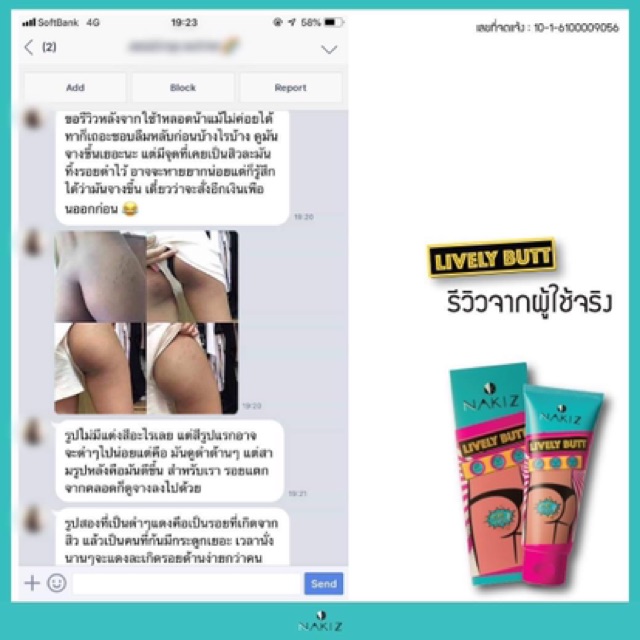 ส่งฟรี-2หลอด-nakiz-lively-butt-ครีมลดบั้นท้ายดำ-ขาหนีบดำ-รักแร้ดำ-หัวเข่าดำ-ข้อศอกดำ-นาคิซ-ครีม-nakiz-ครีมแตกลาย