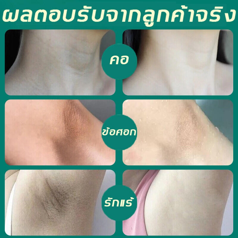 aichun-เครื่องดูดฝุ่นผิว-ครีมทาผิวขาว-ครีมทาก้นดำลาย-ขาหนีบดำ-ครีมรักแร้ขาว-ครีมทารักแร้ดำ-ครีมบำรุงรักแร้-ครีมทาก้นขาว-ครีมทารักแร้ขาว-ครีมเข่าขาว-ครีมทาขาหนีบ-ครีมทาคอ-ไวท์เทนนิ่งและกระชับ-ผิวคอเต่ง