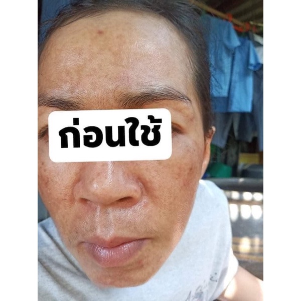 ส่งฟรี-เซ็ตสลายฝ้า-เซรั่มคอลลาเจน-เซรั่มฝ้า-ลดฝ้า-กระ-จุดด่างดำ-ผิวขาวใส-รูขุมขนกระชับ-ลดการเกิดริ้วรอย-ชาริยาสกินแคร์