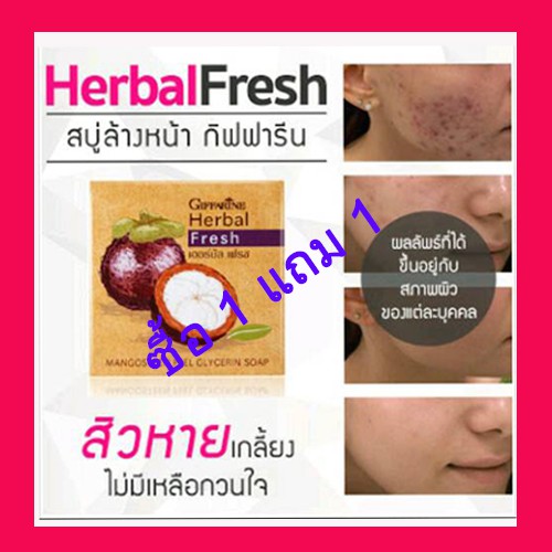 สบู่มังคุดรักษาสิว-giffarine-herbal-mangosteen-peel-glycerin-soap-สิวอักเสบ-สิวหัวหนอง-ควบคุมความมันบนใบหน้า-ลดแบคทีเรีย